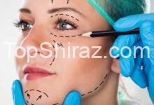 بهترین پزشکان جراحی پلاستیک و زیبایی شیراز