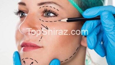 بهترین پزشکان جراحی پلاستیک و زیبایی شیراز